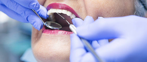 Best Emergency Root Canal Treatment in Paden City, WV